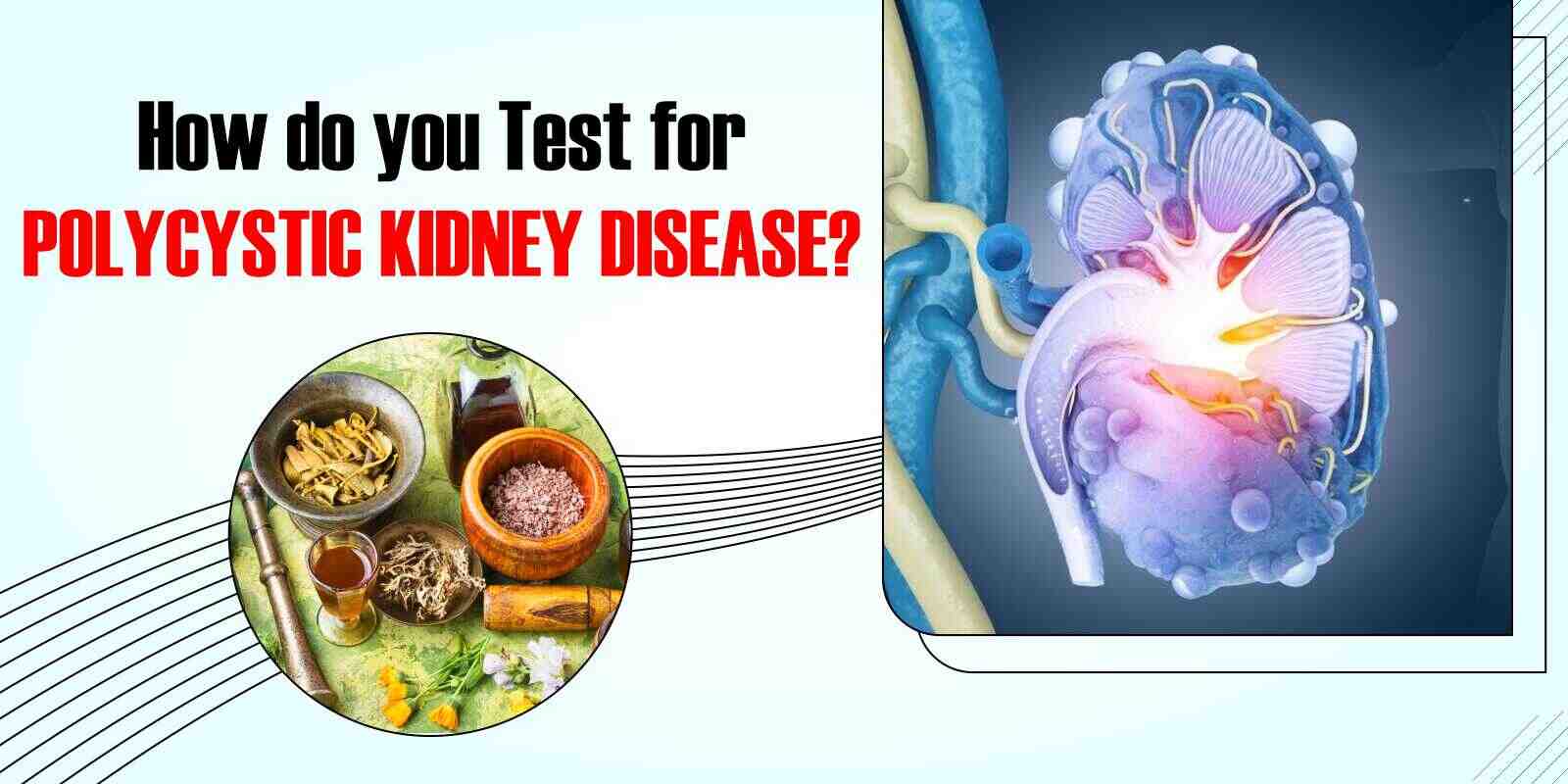 How do you Test for Polycystic Kidney Disease?